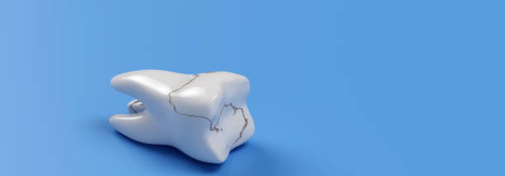 Broken tooth isolated on blue background. 3d render illustration Broken tooth isolated on blue background. 3d render illustration