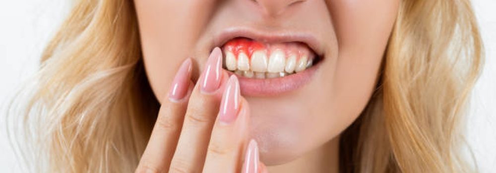 Young woman suffering from toothache Young woman suffering from toothache