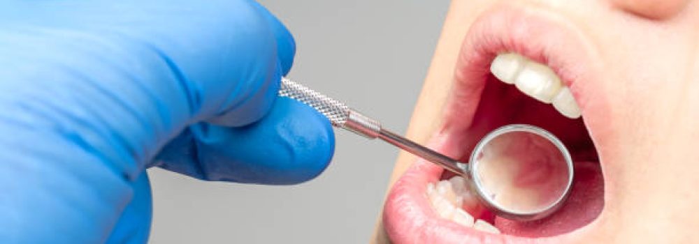 Close up of dentist hand examining patient teeth with dental mirror in checkup. Close up of dentist hand examining patient teeth with dental mirror in checkup.