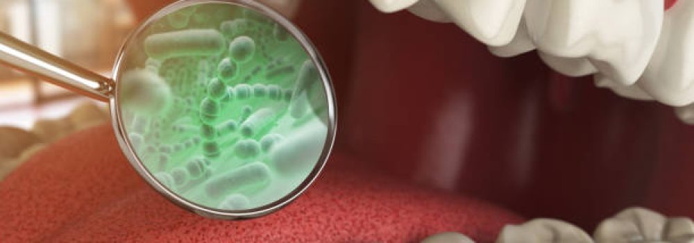 istockphoto-642891480-612×612 Bacterias and viruses around tooth. Dental hygiene medical concept. 3d illustration